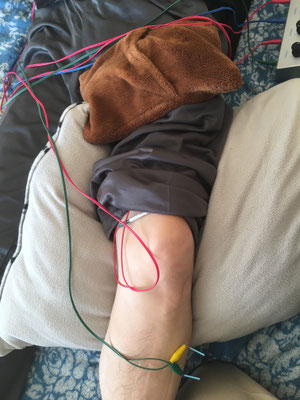 麻痺足を温める