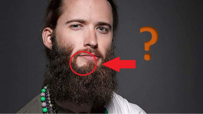 por que no me sirve el minoxidil para barba