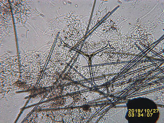 Theonella  conica, grand desmes à 3 branches