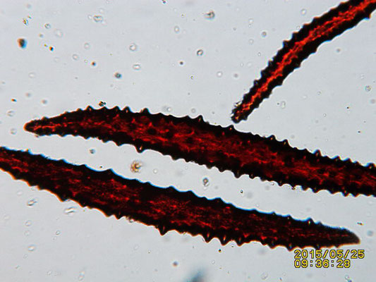 Dendronephthya  klunzingeri  sclérites