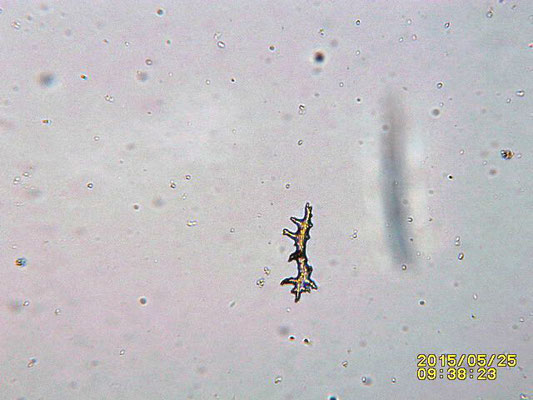 Dendronephthya  klunzingeri  sclérite et objet inconnu