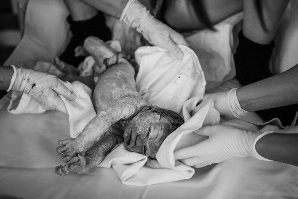 Geburtsfotograf, Geburtsdoku, Hausgeburt, Wochenbettfotografie, 48 fresh, Klinik Krankenhaus Zwickau, Plauen,Gera,