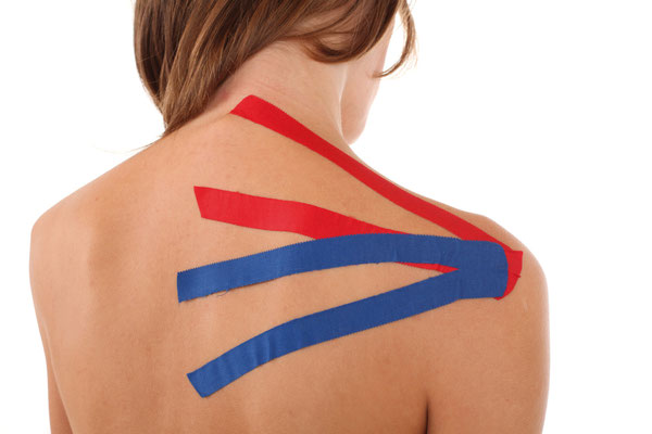 Kinesio Tape - Bewegungsfreiheit ohne Schmerzen