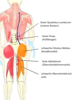 Zeichnung der Piriformis Muskulatur
