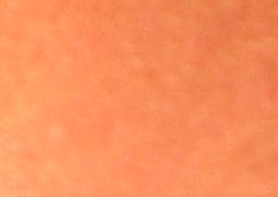 photo 5.01