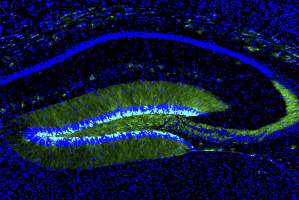 2: 生後脳・成体脳ニューロン新生 - brainnetworks ページ! 2: 生後脳・成体脳ニューロン新生 - brainnetworks ページ!