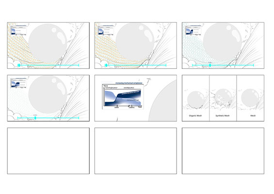 Storyboard about different types of surgical meshes used to promote wound healing in breast implant surgeries. Made in service of Demcon | Nymus3D - page 03