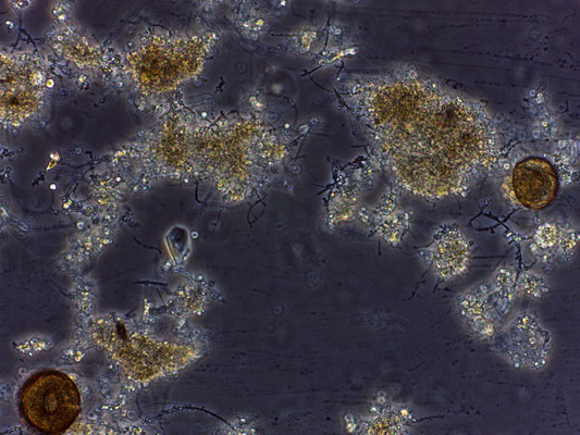 25. Ameba testácea