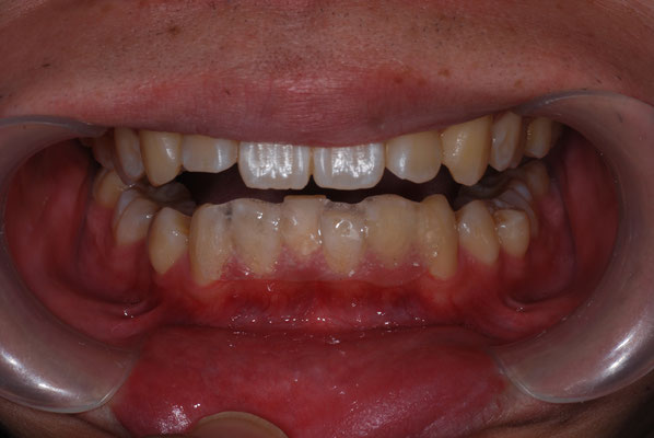 すべての管楽器奏者へ ある歯科医の提言 すべての管楽器奏者へ―ある歯科医の提言 | 根本 俊男 |本 | 通販