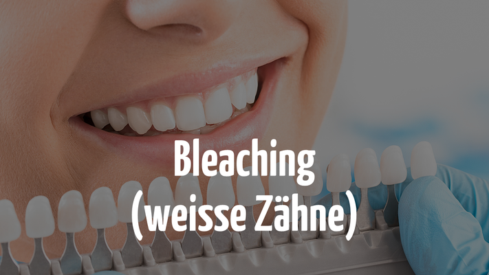 Weisse Zähne mit Bleaching beim Zahnarzt in Bern
