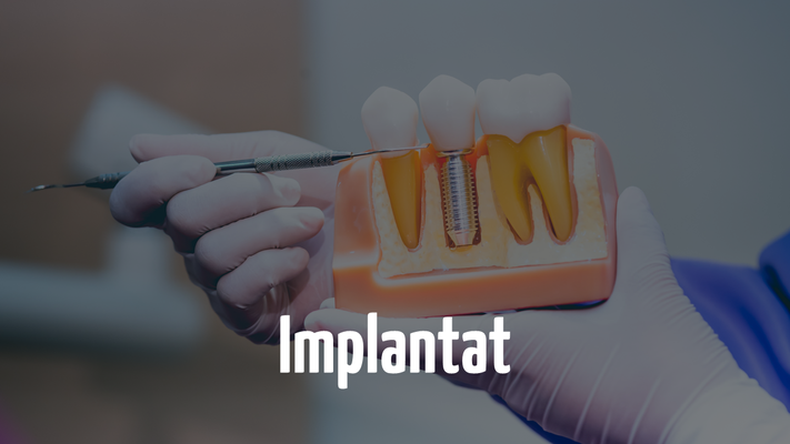 Implantat