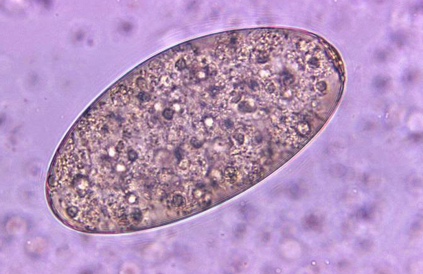 Oeuf de Fasciolopsis buski (http://diagnosticparasitology.blogspot.com/2014/05/fasciolopsis-buski.html)