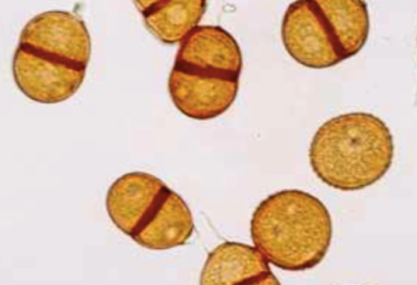 Spore de rouille du pissenlit (Puccinia variabilis) (Petithory et al., 1995)
