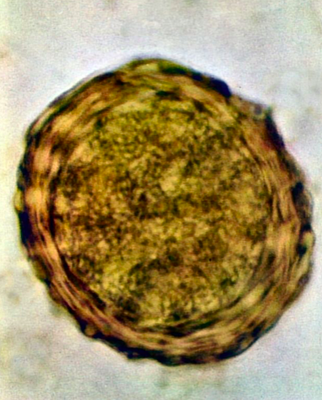 Oeuf d'Ascaris spp. embryonné (http://www.wikiwand.com/en/Ascaris_lumbricoides)