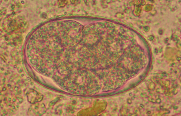 Oeuf d'Ancyolostoma spp. (https://www.researchgate.net/figure/Ancylostoma-duodenale-egg-morula_fig5_7226387)