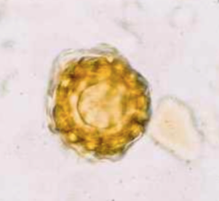 Spore de mildiou du pois (Peronospora pisi) (Petithory et al., 1995)
