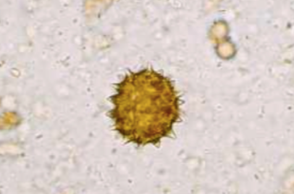 Pollen de chardon (Cirsium arvense) (Petithory et al., 1995)