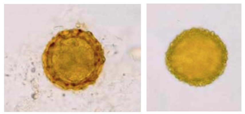 Oeuf d'Ascaris spp. embryonné (gauche) et pollen de carthame (Carthamus tinctorius, à droite) (Petithory et al., 1995)