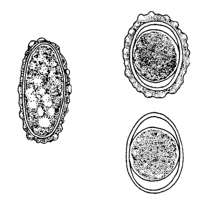 Oeufs d'Ascaris spp. non embryonné (gauche) et embryonnés (droite). L'oeuf en bas à droite est nu (https://www.researchgate.net/figure/Eggs-of-Ascaris-lumbricoides_fig18_233727096)