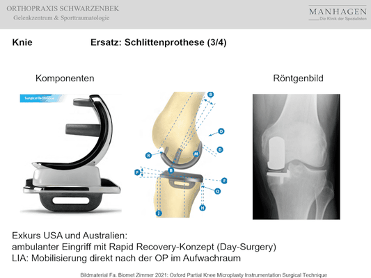Orthopraxis Schwarzenbek - Orthopädie Update - Schlittenprothese