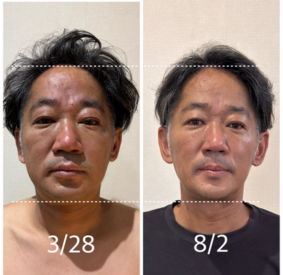 はりす　繁盛治療院のしくみ 繁盛治療院のしくみ 214の絶対法則 | 花谷 博幸 |本 | 通販 | Amazon