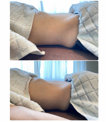 下腹部の張りや内臓下垂が軽減し、胃の周りもスッキリ