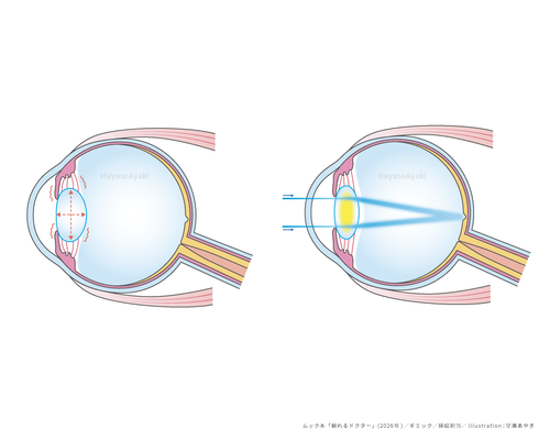 目　眼科　白内障　老眼　解剖生理　挿絵　イラスト