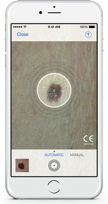 4. Hautkrebsvorsorge per Smartphone: Einfach ein Foto von der Hautveränderung machen und von der dazugehörigen App analysieren lassen: Gutartig oder verdächtig? Weil jeden Tag neue Fotos dazukommen, wird die App durch maschinelles Lernen immer klüger. Hau