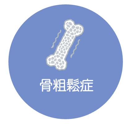 骨粗鬆症