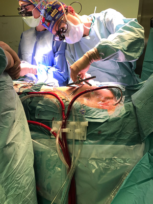 Canulación periférica