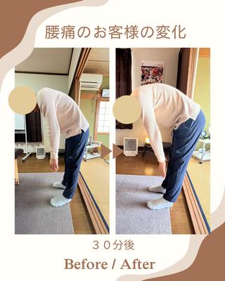 新潟市東区の整体院 N Cure（エヌキュア） 腰痛改善・前屈動作のビフォーアフター実績写真