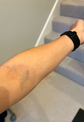 Bluet näh lah wegem Medical Test - schiinend Profis z'sii :P