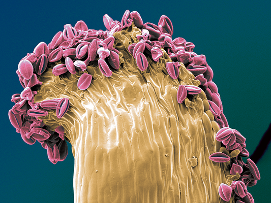 on top - Chimonanthus, Staubblatt mit Pollenkörnern - Druck auf Leinwand, 60x45 cm, 2012, REM-Aufnahme und Coloration: S. Ulrich - VERKAUFT
