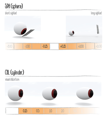 infographic ophthalmologist
