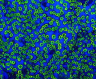 Montipora