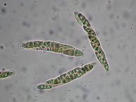 Diaporthe oncostoma-Asci-Sporen 