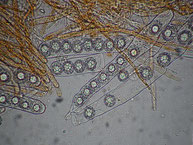 Lamprospora miniata-Asci-Sporen-Paraphysen Präparat in Leitungswasser
