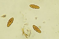 Gloniopsis praelonga 