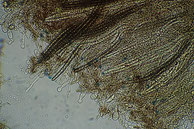 Geoglossum fallax-Asci mit Sporen-Paraphysen