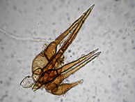 Trichophaea woolhopeia-Randhaare