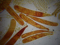 Claussenomyces xylophilus Asci mit Primärsporen und Konidienballen cf.