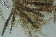 Geoglossum fallax-Asci mit Sporen