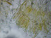 Cudoniella rubicunda-Asci-Sporen-Paraphysen