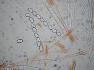 Asci-Sporen-Paraphysen