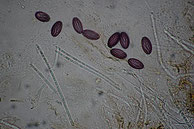 Ascobolus furfuraceus-reife Sporen-Paraphysen-Präparat in Lugol angefertigt