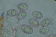 Neottiella albocincta-Sporen