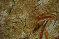 Geoglossum cookeianum-Asci-Sporen-Paraphysen, Präparat in Lugol