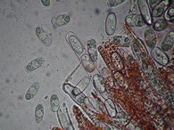 Sarcoscypha jurana-Asci-Sporen-Paraphysen
