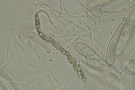 Lophiostoma vagabundum, Asci Sporen, Paraphysen