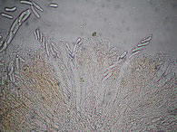 Calloria neglecta-Asci-Sporen